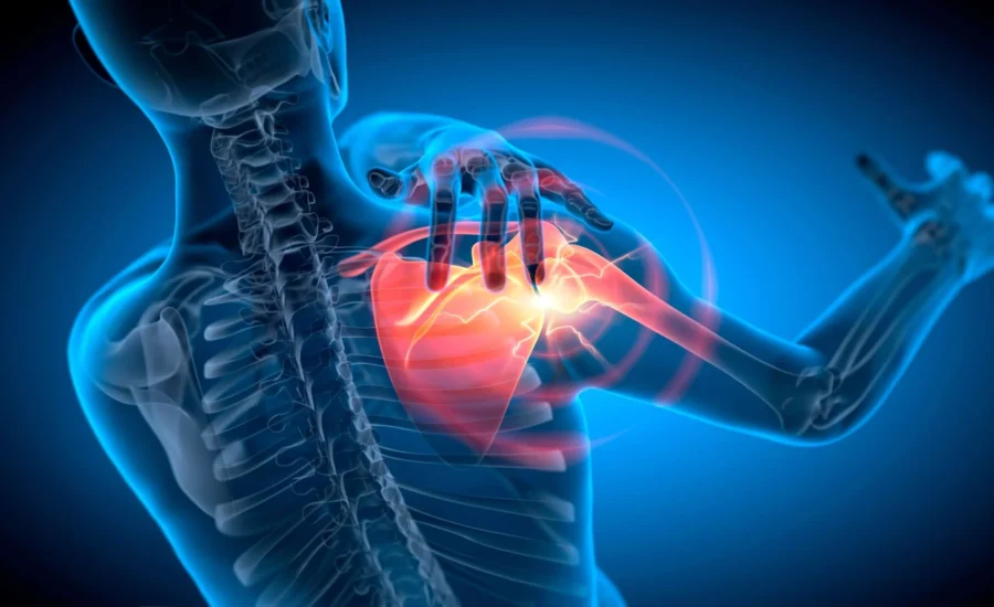 Desgarro Del Manguito Rotador